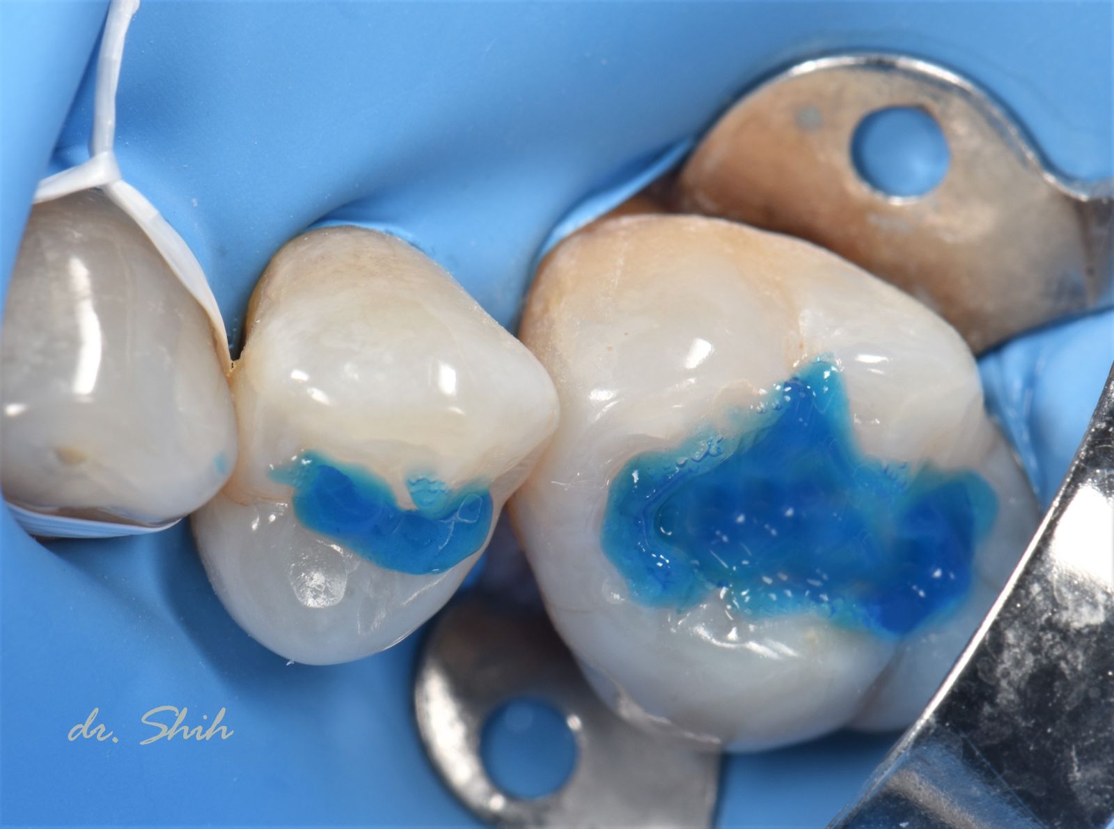 i-GEL_dr_Shih